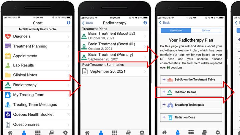 Design and implementation of a prototype radiotherapy menu in a patient portal