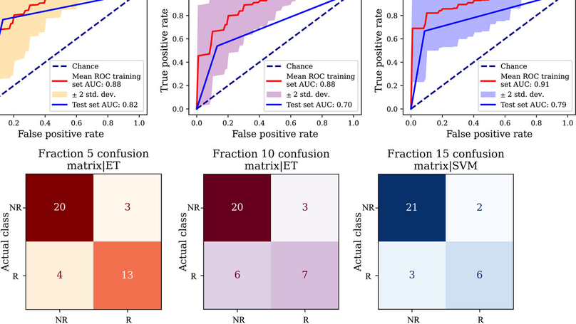 Quantification of head and neck cancer patients’ anatomical changes during radiotherapy: Toward the prediction of replanning need